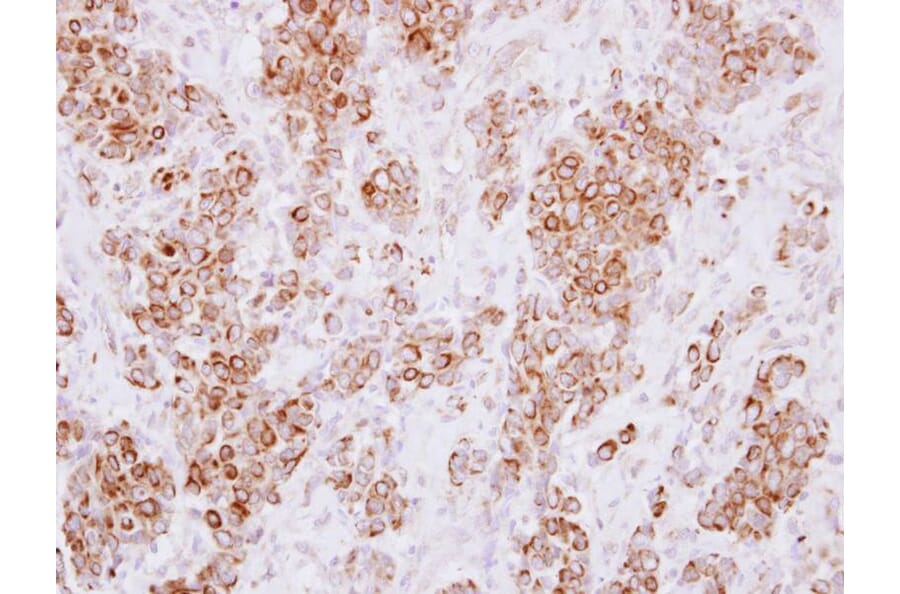 Immunohistochemistry - HLA-DMA antibody from Signalway Antibody (22427) - Antibodies.com