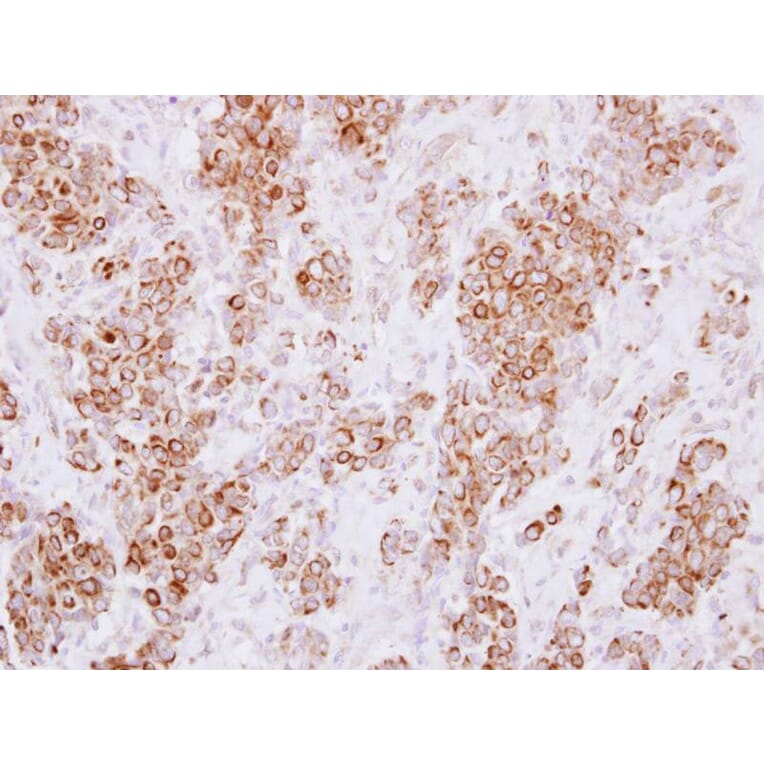 Immunohistochemistry - HLA-DMA antibody from Signalway Antibody (22427) - Antibodies.com