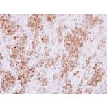 Immunohistochemistry - HLA-DMA antibody from Signalway Antibody (22427) - Antibodies.com