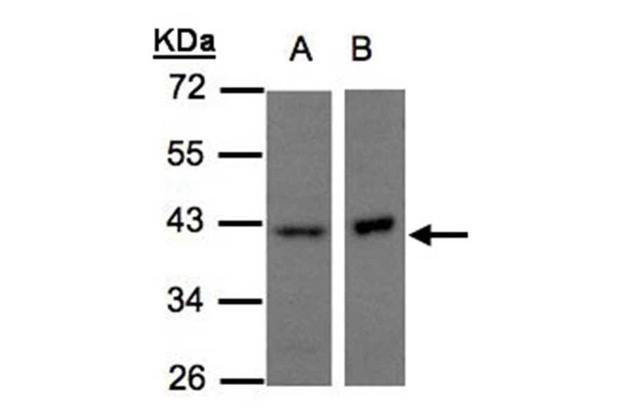 NDUFA10 antibody from Signalway Antibody (22429) - Antibodies.com