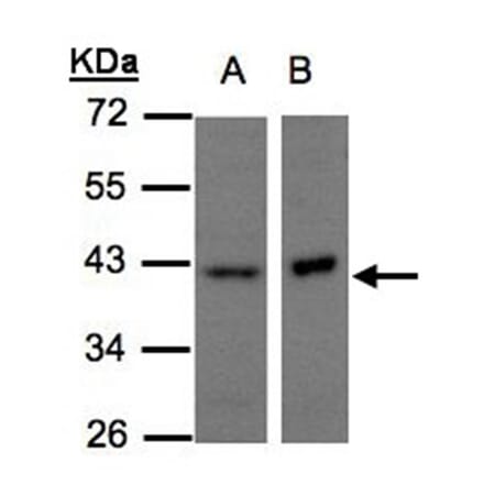 NDUFA10 antibody from Signalway Antibody (22429) - Antibodies.com