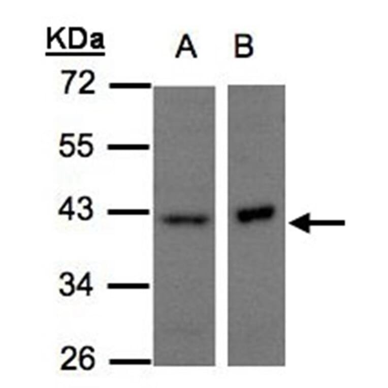 NDUFA10 antibody from Signalway Antibody (22429) - Antibodies.com
