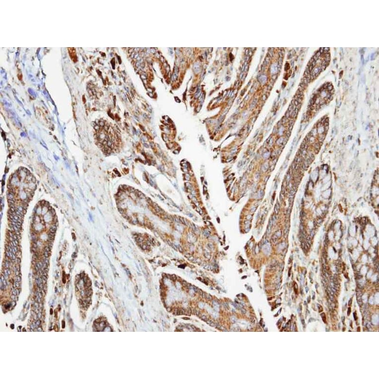 Immunohistochemistry - NDUFA10 antibody from Signalway Antibody (22429) - Antibodies.com
