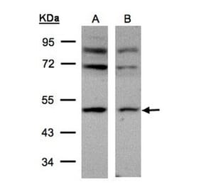 AP-2M1 antibody from Signalway Antibody (22460) - Antibodies.com