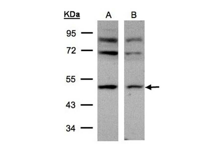 AP-2M1 antibody from Signalway Antibody (22460) - Antibodies.com