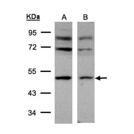 AP-2M1 antibody from Signalway Antibody (22460) - Antibodies.com