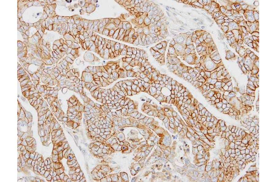 Immunohistochemistry - AP-2M1 antibody from Signalway Antibody (22460) - Antibodies.com