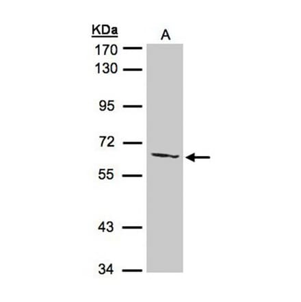 AGXT2L1 antibody from Signalway Antibody (22545) - Antibodies.com