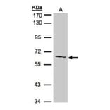AGXT2L1 antibody from Signalway Antibody (22545) - Antibodies.com