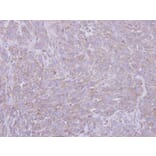 Immunohistochemistry - SIGLEC9 antibody from Signalway Antibody (22552) - Antibodies.com