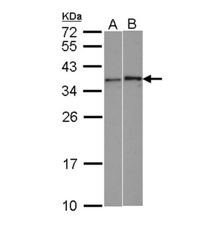 WBSCR22 antibody from Signalway Antibody (22602) - Antibodies.com