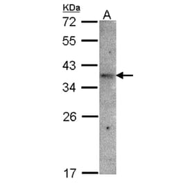 GPR 164 antibody from Signalway Antibody (22824) - Antibodies.com