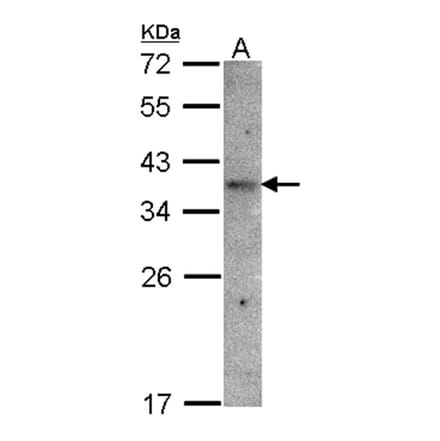 GPR 164 antibody from Signalway Antibody (22824) - Antibodies.com