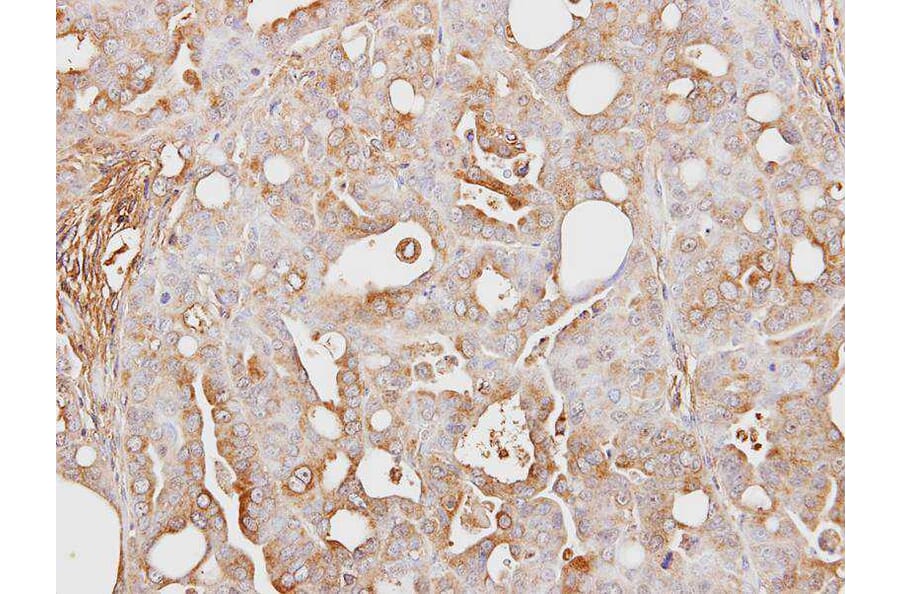 Immunohistochemistry - ITI-H3 antibody from Signalway Antibody (23029) - Antibodies.com