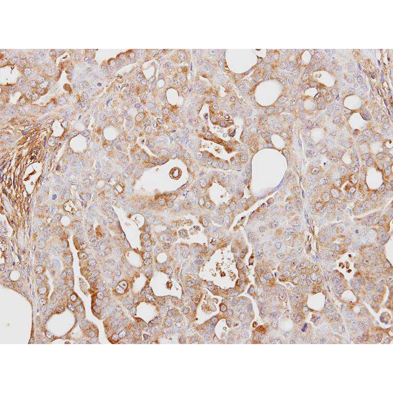 Immunohistochemistry - ITI-H3 antibody from Signalway Antibody (23029) - Antibodies.com