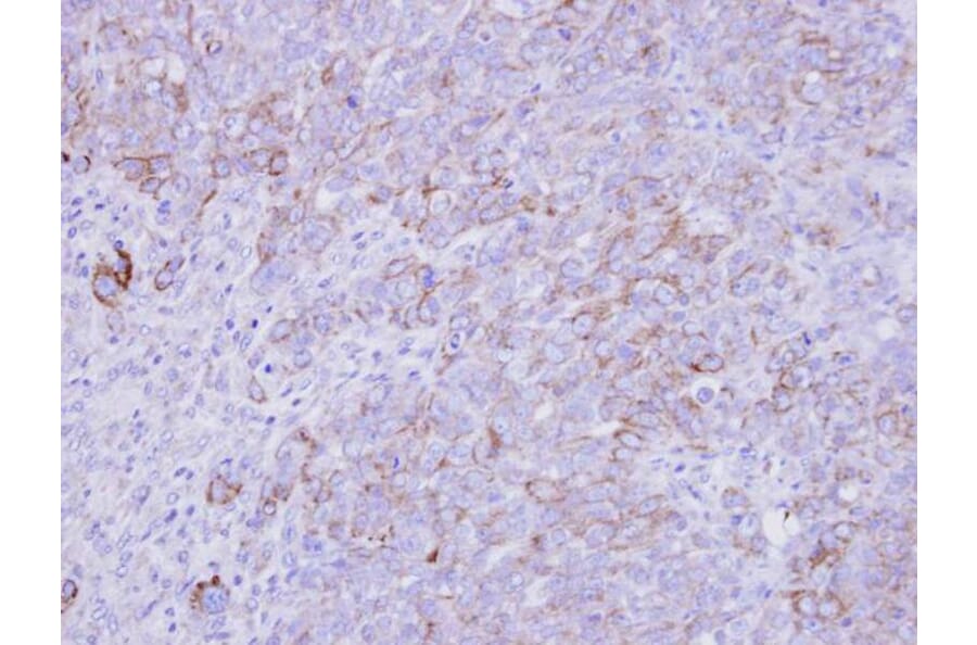 Immunohistochemistry - SLC26A8 antibody from Signalway Antibody (23164) - Antibodies.com