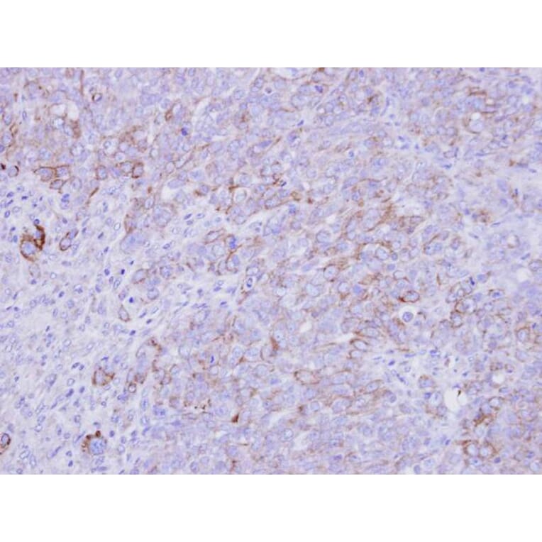 Immunohistochemistry - SLC26A8 antibody from Signalway Antibody (23164) - Antibodies.com