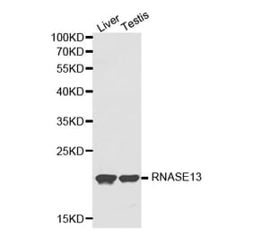 Western blot - RNASE13 Antibody from Signalway Antibody (32146) - Antibodies.com