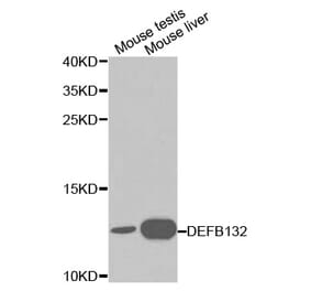 Western blot - DEFB132 Antibody from Signalway Antibody (32147) - Antibodies.com