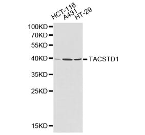 Western blot - TACSTD1 Antibody from Signalway Antibody (32206) - Antibodies.com