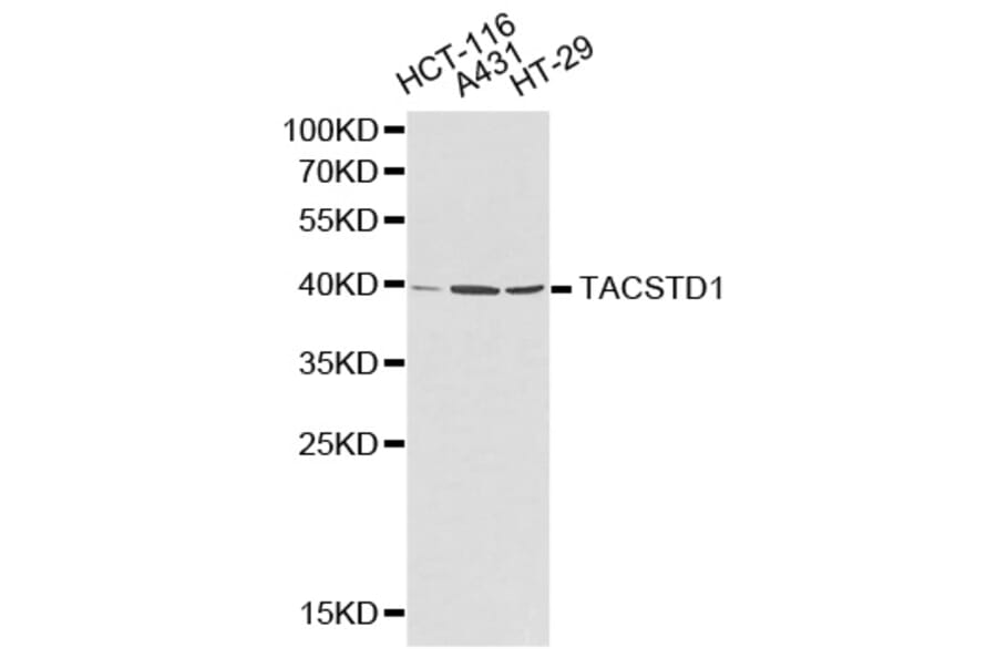 Western blot - TACSTD1 Antibody from Signalway Antibody (32206) - Antibodies.com