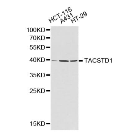 Western blot - TACSTD1 Antibody from Signalway Antibody (32206) - Antibodies.com