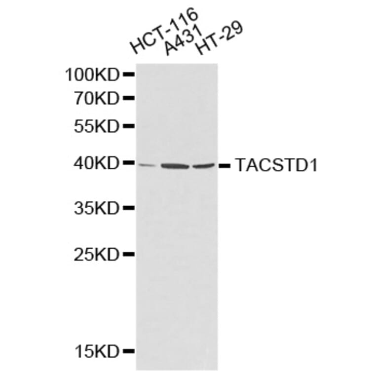 Western blot - TACSTD1 Antibody from Signalway Antibody (32206) - Antibodies.com