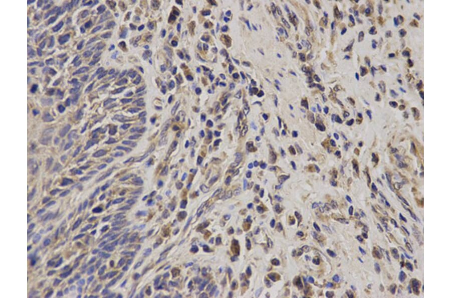 Immunohistochemistry - TACSTD1 Antibody from Signalway Antibody (32206) - Antibodies.com