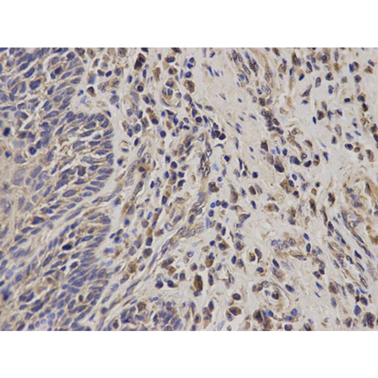 Immunohistochemistry - TACSTD1 Antibody from Signalway Antibody (32206) - Antibodies.com