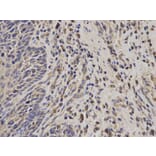 Immunohistochemistry - TACSTD1 Antibody from Signalway Antibody (32206) - Antibodies.com