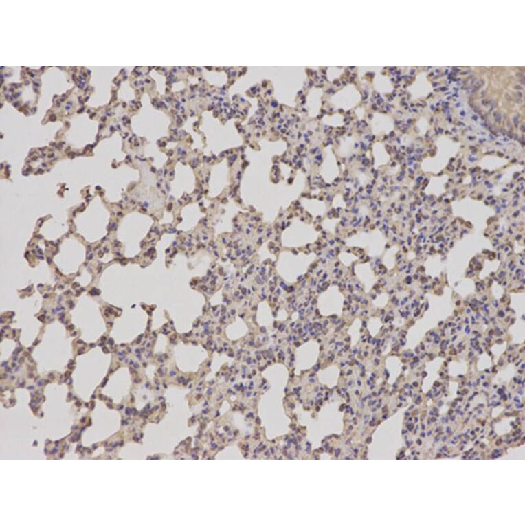 Immunohistochemistry - TACSTD1 Antibody from Signalway Antibody (32206) - Antibodies.com