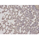 Immunohistochemistry - TACSTD1 Antibody from Signalway Antibody (32206) - Antibodies.com