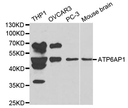 Western blot analysis of extracts of various cell lines, using ATP6AP1 antibody.