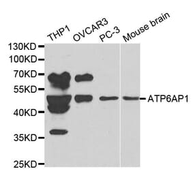 Western blot - ATP6AP1 Antibody from Signalway Antibody (32229) - Antibodies.com