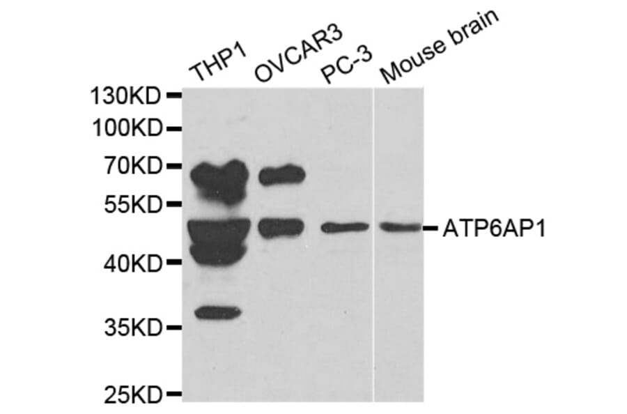 Western blot - ATP6AP1 Antibody from Signalway Antibody (32229) - Antibodies.com