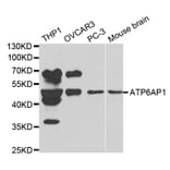 Western blot - ATP6AP1 Antibody from Signalway Antibody (32229) - Antibodies.com