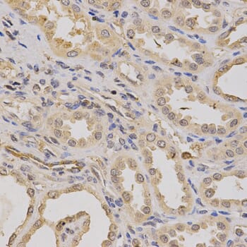 Immunohistochemistry of paraffin-embedded human kidney using ATP6AP1 antibody at dilution of 1: 200 (x400 lens).