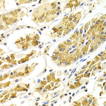 Immunohistochemistry of paraffin-embedded Human gastric using ATP6AP1 antibody at dilution of 1: 100 (x400 lens).