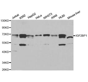 Western blot - IGF2BP1 Antibody from Signalway Antibody (32294) - Antibodies.com
