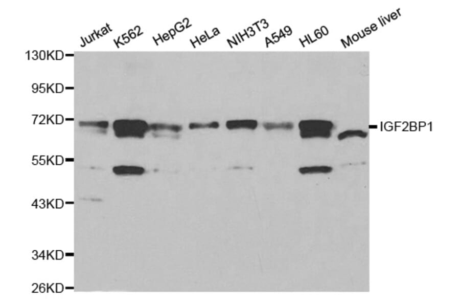 Western blot - IGF2BP1 Antibody from Signalway Antibody (32294) - Antibodies.com