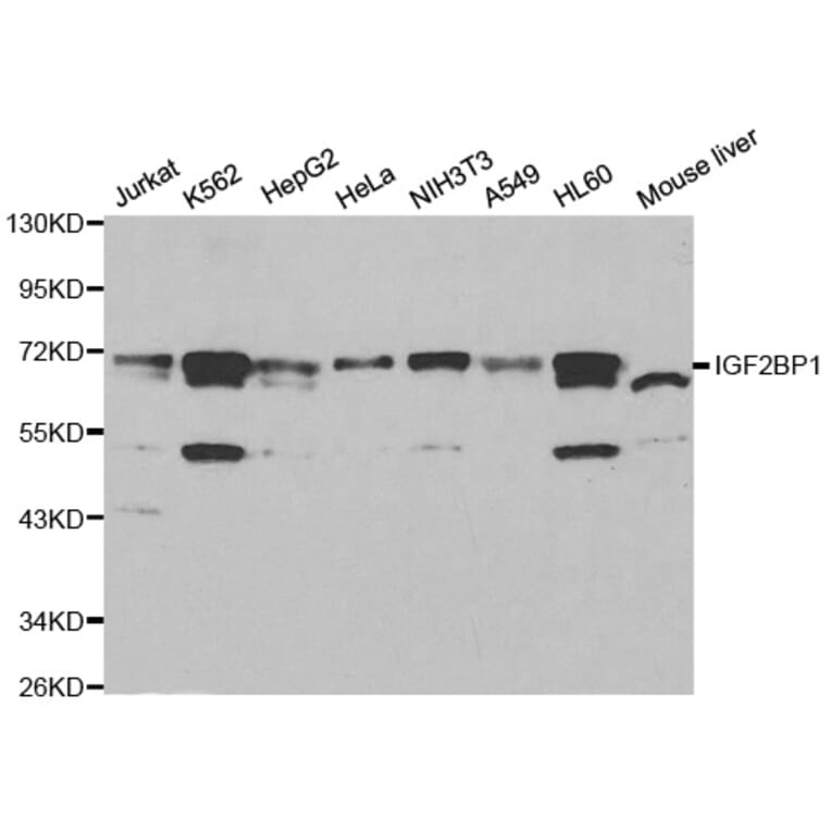 Western blot - IGF2BP1 Antibody from Signalway Antibody (32294) - Antibodies.com