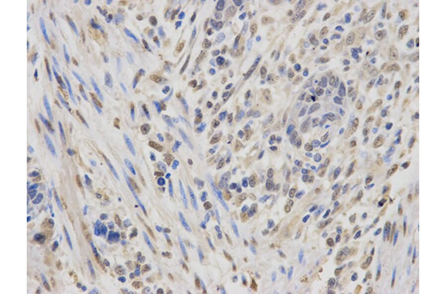 Immunohistochemistry - IGF2BP1 Antibody from Signalway Antibody (32294) - Antibodies.com