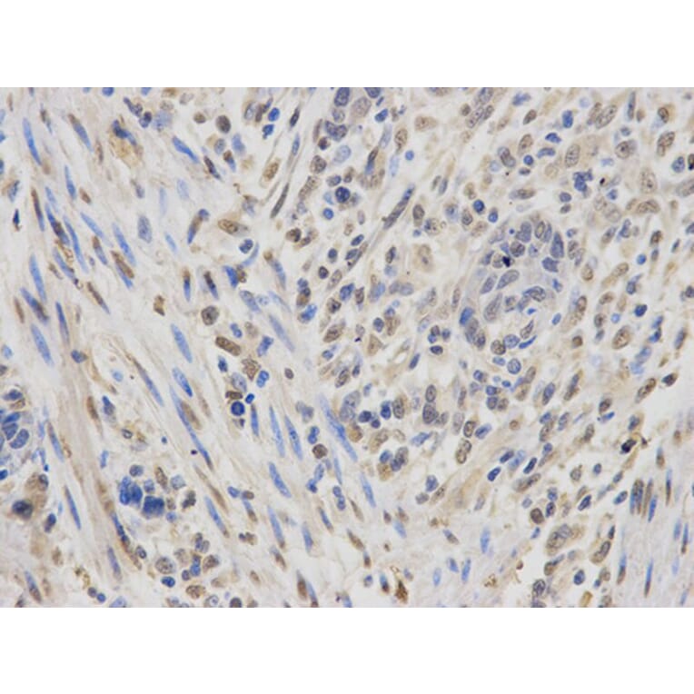 Immunohistochemistry - IGF2BP1 Antibody from Signalway Antibody (32294) - Antibodies.com