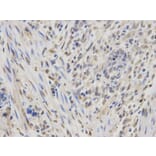 Immunohistochemistry - IGF2BP1 Antibody from Signalway Antibody (32294) - Antibodies.com