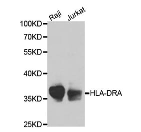 Western blot - HLA-DRA Antibody from Signalway Antibody (32324) - Antibodies.com