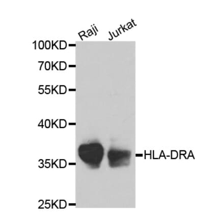 Western blot - HLA-DRA Antibody from Signalway Antibody (32324) - Antibodies.com
