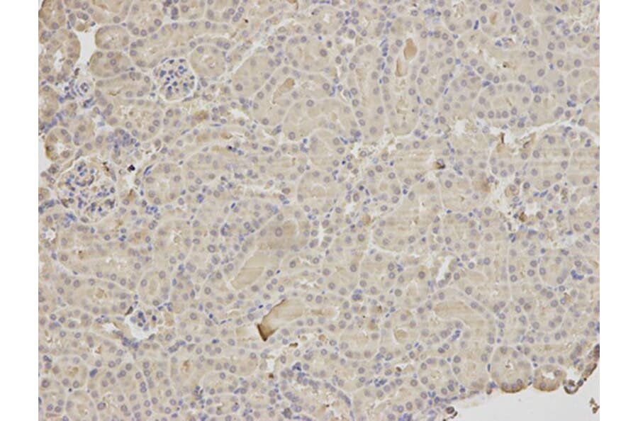 Immunohistochemistry - HLA-DRA Antibody from Signalway Antibody (32324) - Antibodies.com