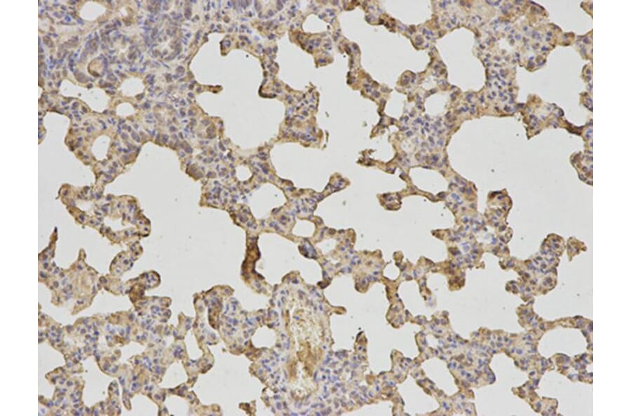 Immunohistochemistry - HLA-DRA Antibody from Signalway Antibody (32324) - Antibodies.com