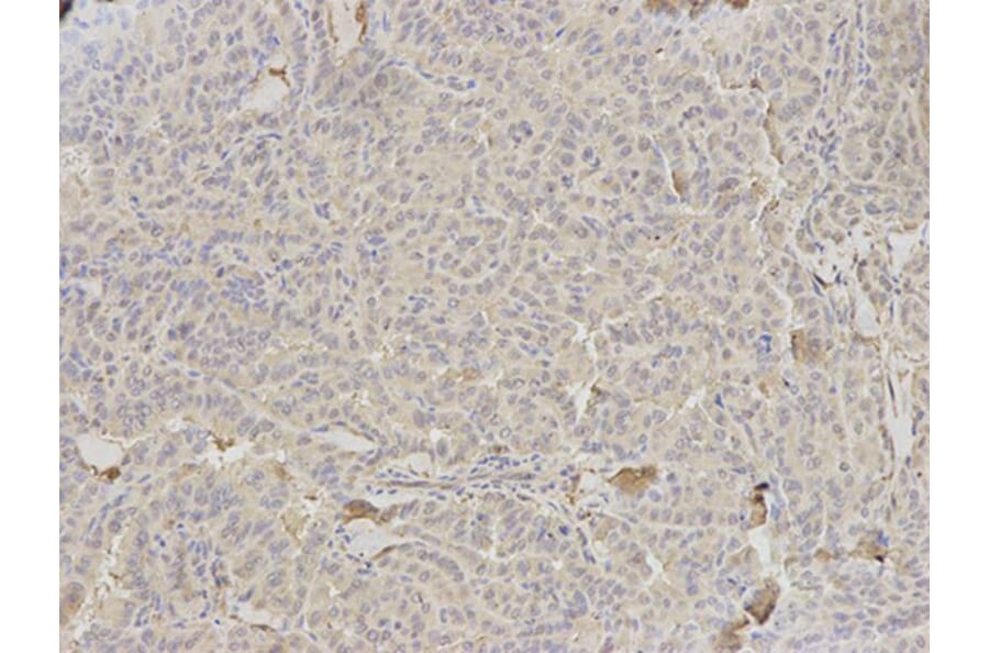 Immunohistochemistry - HLA-DRA Antibody from Signalway Antibody (32324) - Antibodies.com