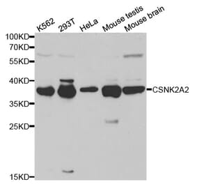 Western blot - CSNK2A2 Antibody from Signalway Antibody (32343) - Antibodies.com